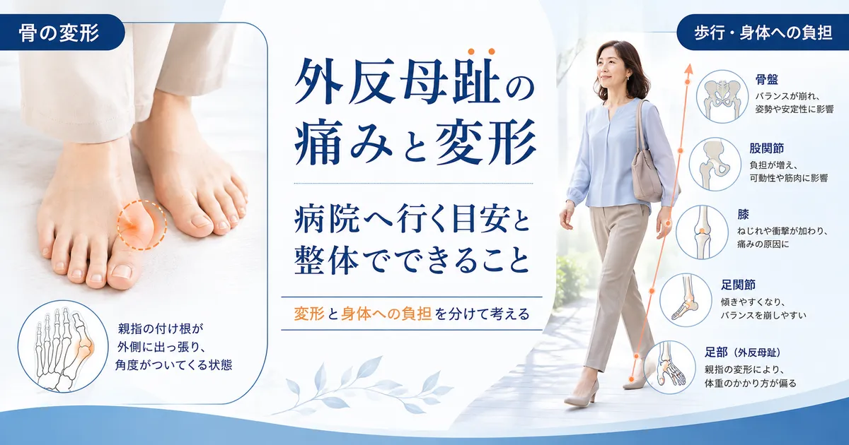 外反母趾の変形と歩行時の身体的負担を分けて考えることを示す図
