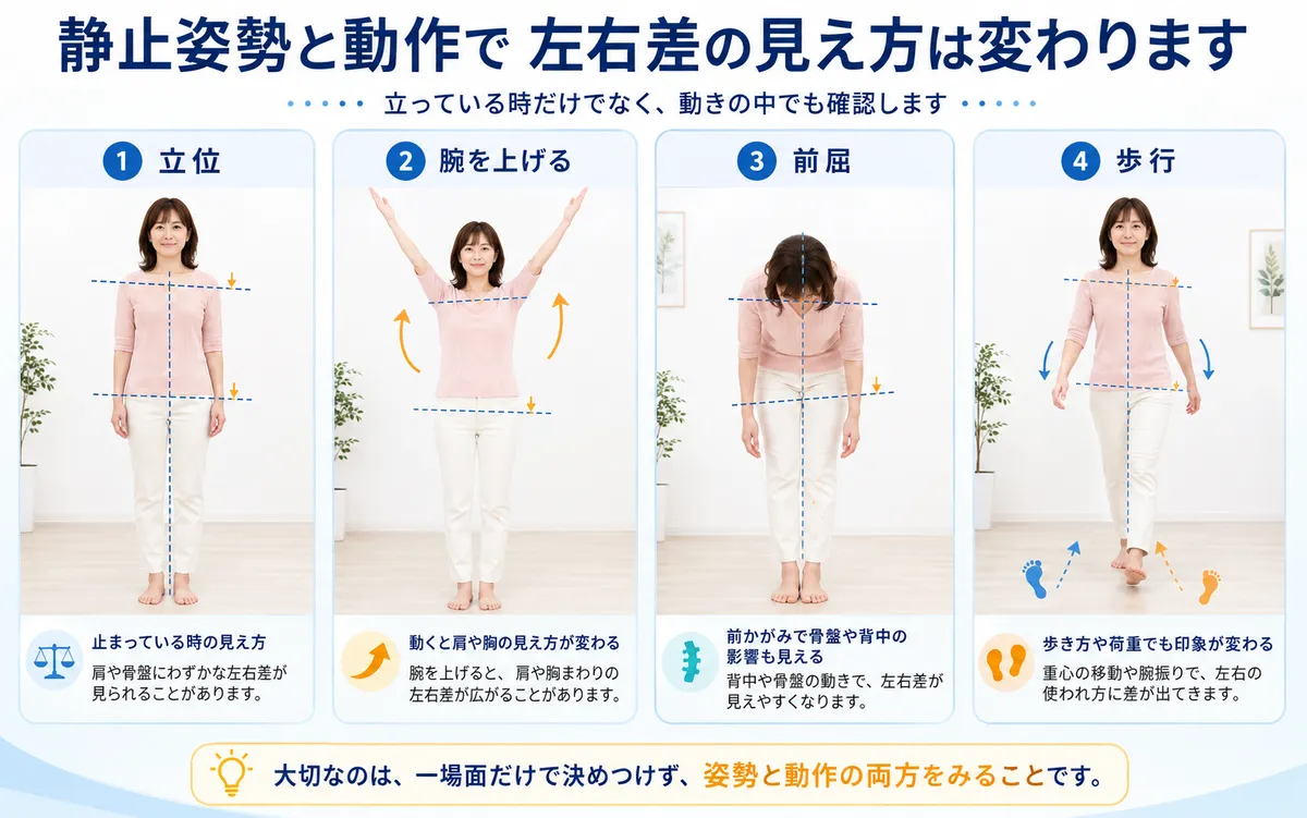 立位と動作時で姿勢の左右差の見え方が変わることを示す比較図