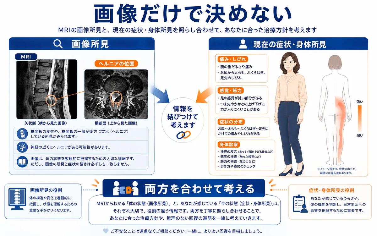 腰椎椎間板ヘルニアのMRI画像所見と痛みやしびれ、筋力など現在の身体所見を合わせて考える図