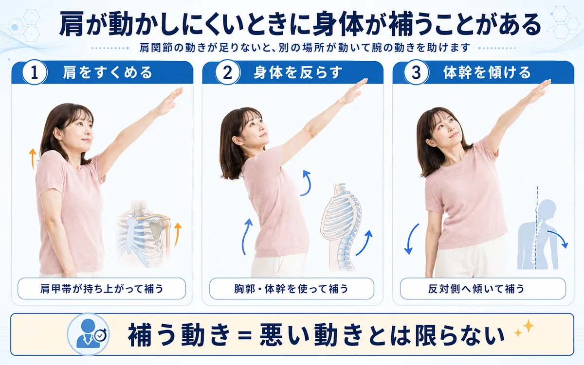 五十肩で肩関節の動きを肩すくめ・体幹の反り・傾きで補う様子
