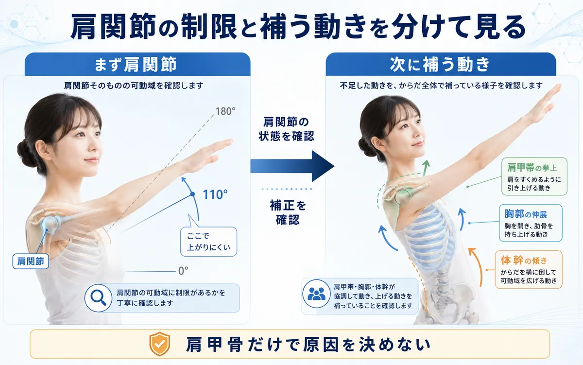 五十肩で肩関節自体の制限と肩甲帯・体幹による補正を分けて確認する考え方