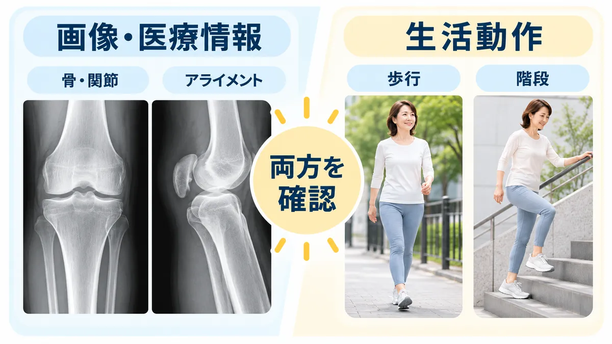 変形性膝関節症で画像所見と歩行・階段などの生活動作を両方確認する図