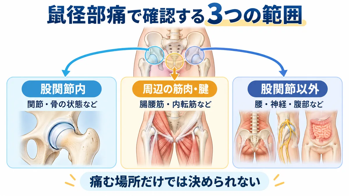 鼠径部痛で確認する股関節内・周辺の筋肉や腱・股関節以外の3つの範囲