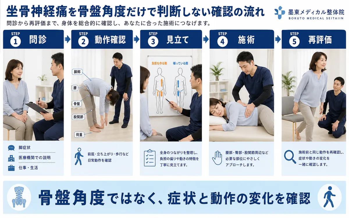 坐骨神経痛がある人を問診、動作確認、見立て、施術、再評価する流れ