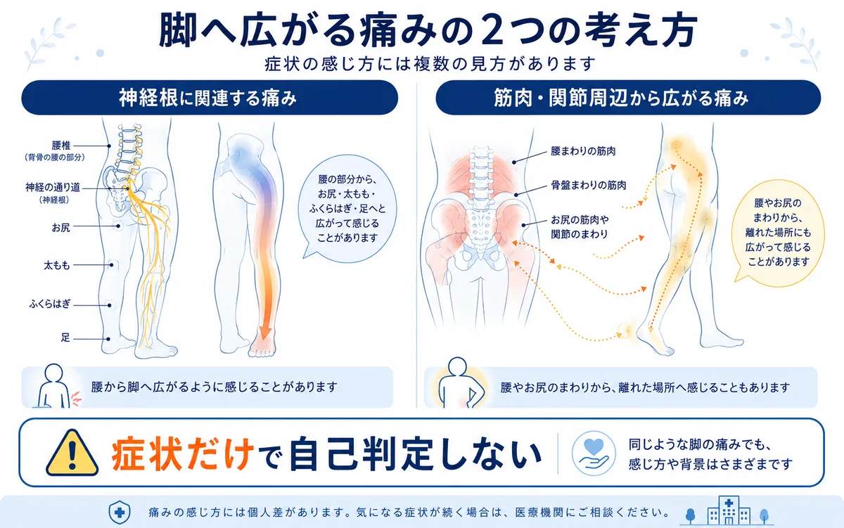 脚へ広がる痛みには神経根に関連する痛みと筋肉や関節周辺から広がる関連痛があることを示す図