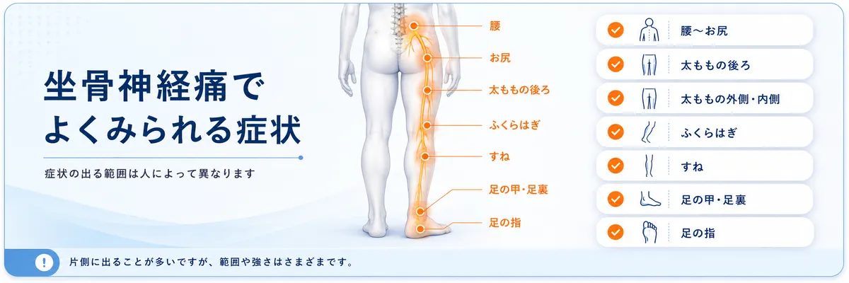 坐骨神経痛でよくみられる症状
