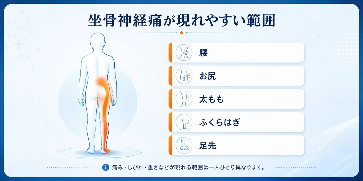 坐骨神経痛が現れやすい箇所