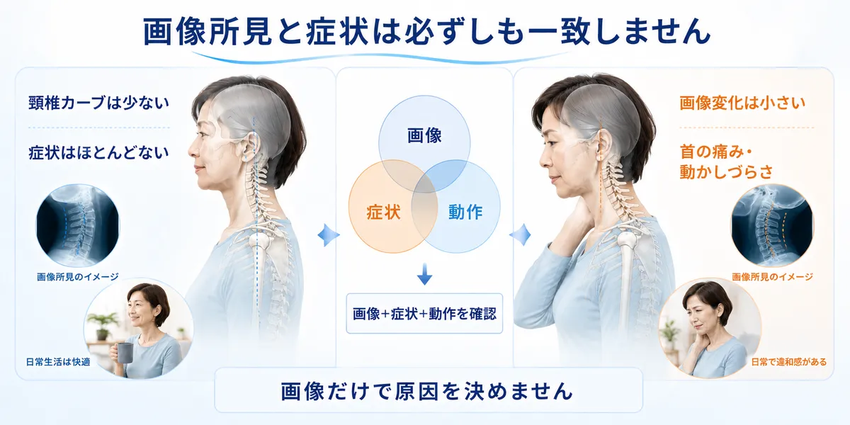 頸椎の画像所見と首の症状が必ずしも一致しないことを示す比較図