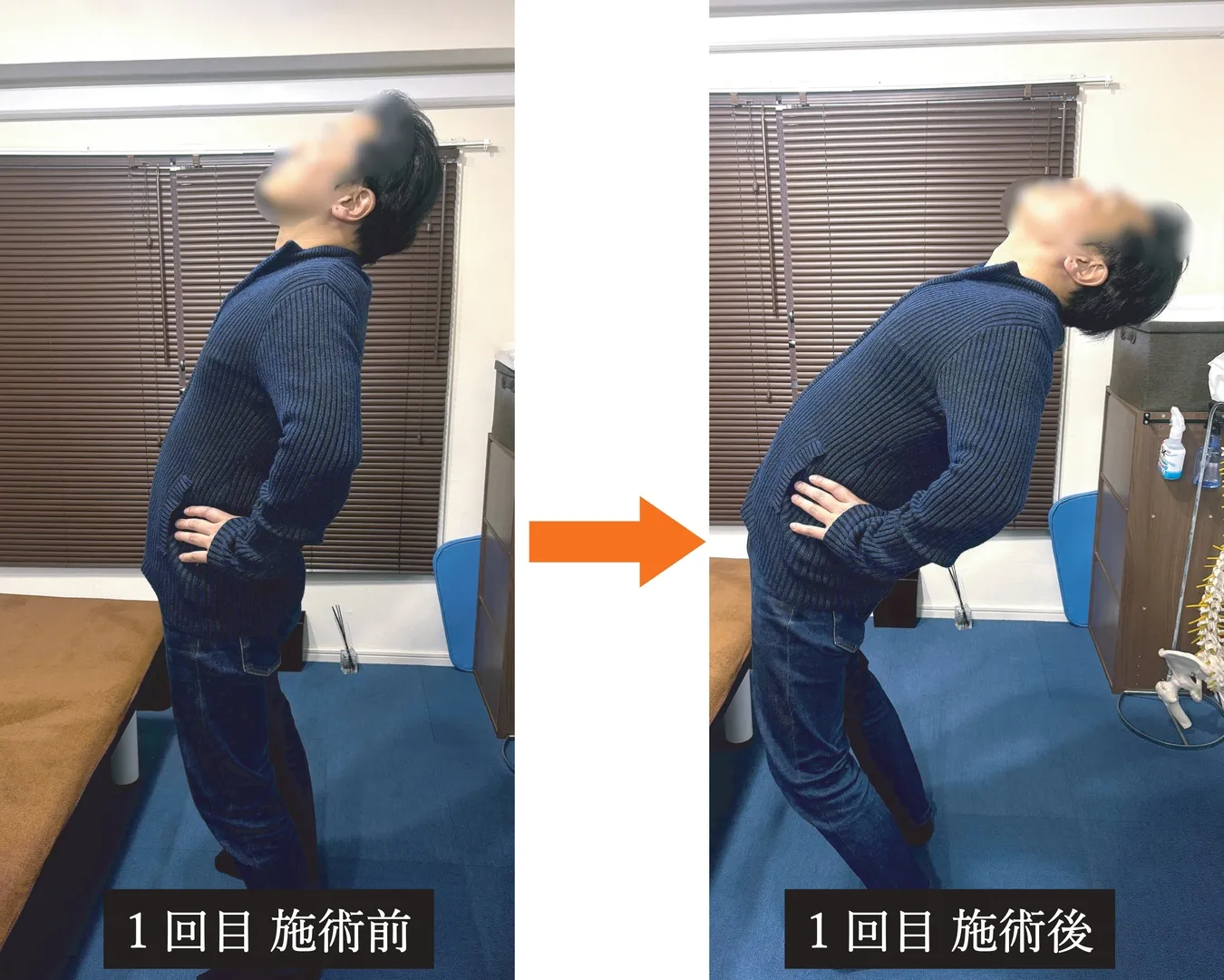 動き出しや立ち上がりの痛み、腰から臀部の詰まりの施術前後比較