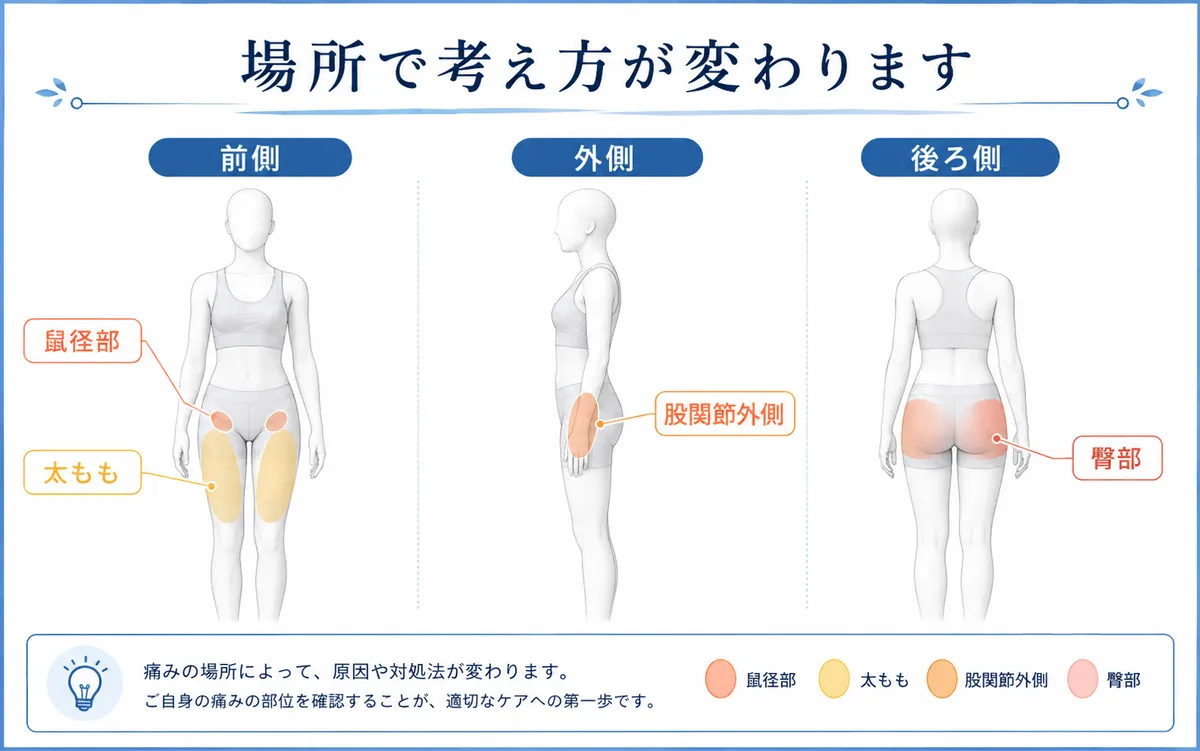 股関節痛で痛みが出やすい部位を示した図