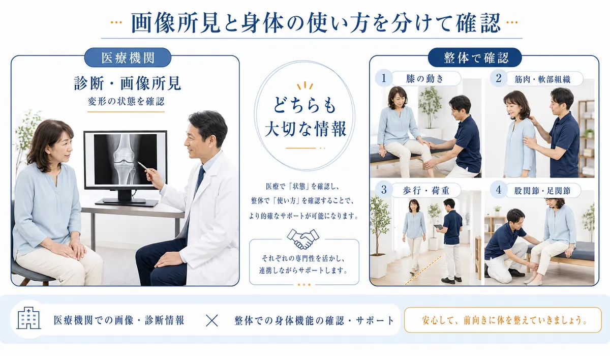 膝の画像所見と歩行や関節の動きをそれぞれ確認する考え方