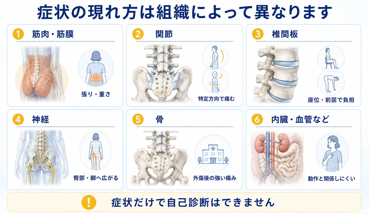 筋肉、関節、椎間板、神経、骨、内臓に関係する腰痛の現れ方の比較