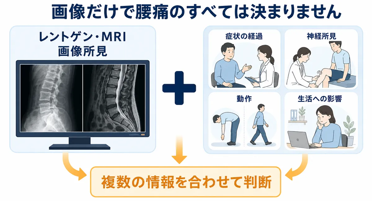 レントゲンやMRIの画像所見と症状、神経所見、動作、生活への影響を合わせて判断する流れ