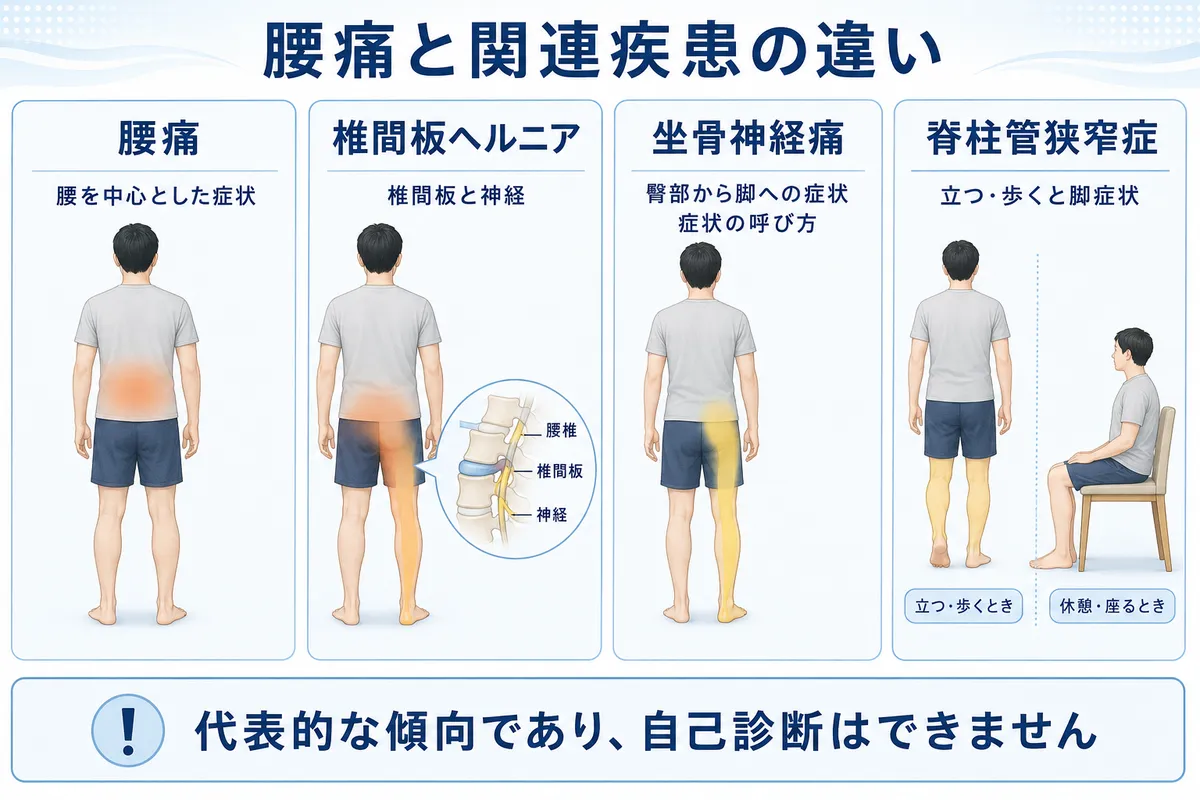 腰痛、椎間板ヘルニア、坐骨神経痛、脊柱管狭窄症の代表的な症状の違い