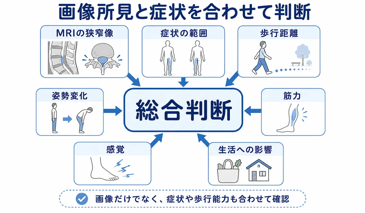 MRIの狭窄像だけでなく症状や歩行距離や筋力や感覚を合わせて総合判断する流れを示した図解
