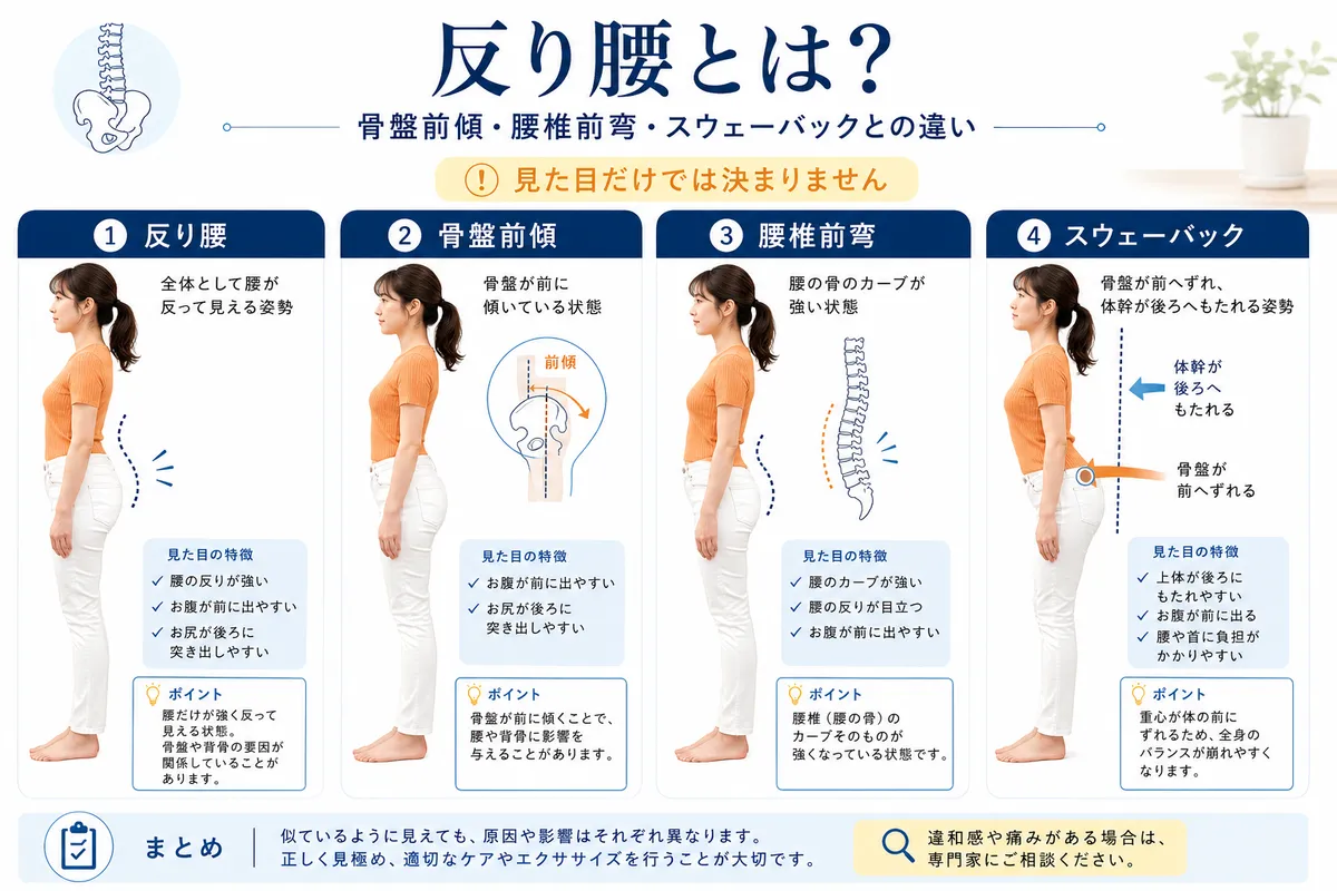 反り腰と骨盤前傾と腰椎前弯とスウェーバックの違いを示した解説ページのメイン画像
