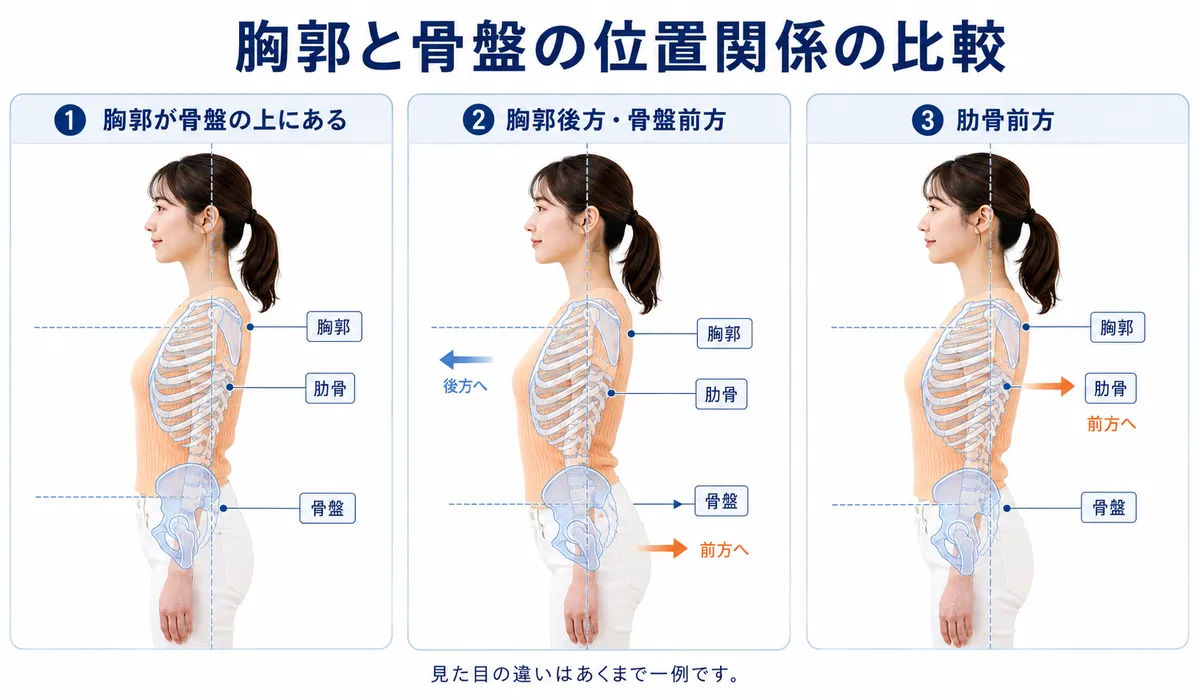 胸郭と骨盤と肋骨の位置関係の違いを比較した図解